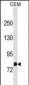 OLFML2B Antibody(N-term)